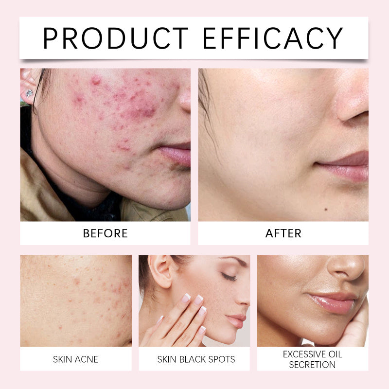 Tampons de nettoyage Kojic Curcuma Shiva ™