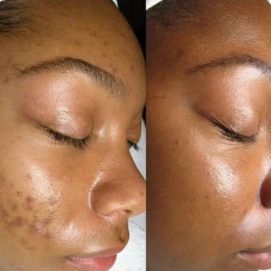 Savon Shiva ™ Glowbar 1 + 1 gratuit