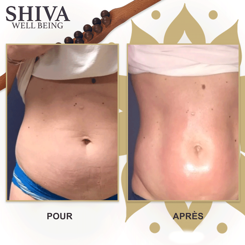 Shiva™ Gua Sha Wooden Therapy tige