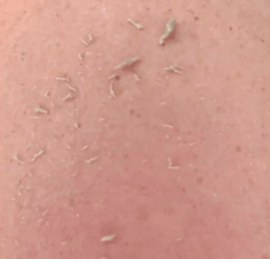 Pack de broussailles SHIVA ™