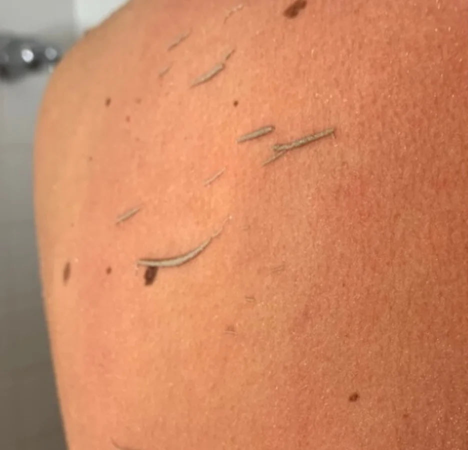 Pack de broussailles SHIVA ™