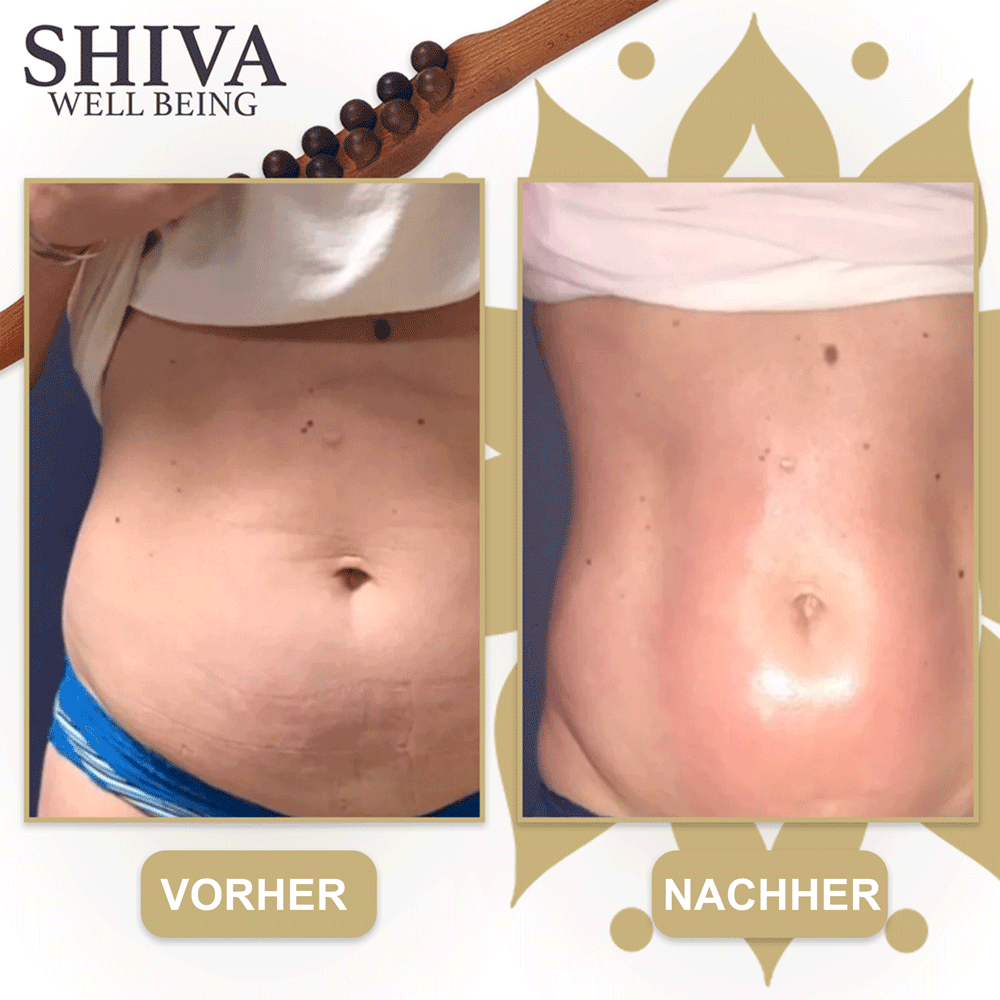 Shiva ™ Gua Sha Wooden Therapy Stab