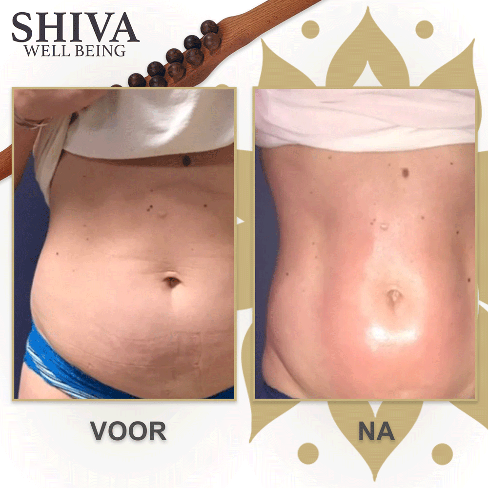 Shiva ™ Gua Sha Wooden Therapy Tod